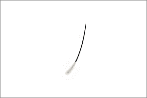 미세모낭 (1모낭)